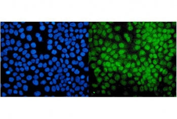 Immunofluorescent staining of FFPE human A431 cells with PIAS1 antibody (green) and DAPI nuclear sta