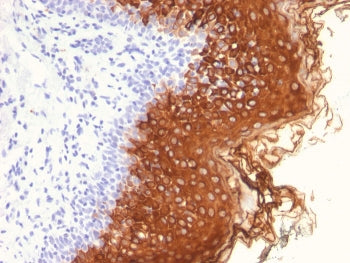 KRT10 Antibody / Cytokeratin 10