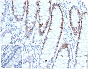 MSH6 Antibody