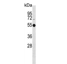 Western blot testing of human Jurkat cell lysate with ATG4C antibody. Predicted molecular weight ~52