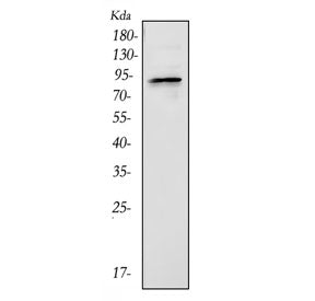 Western blot testing of mouse liver tissue lysate with BCHE antibody. Expected molecular weight: 66-