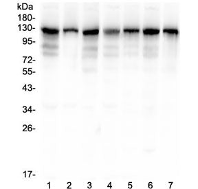 DOG-1 Antibody / TMEM16A / ANO1