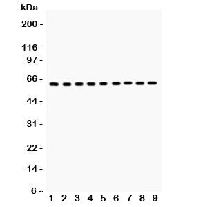 Western blot testing of HSP60 antibody and Lane 1: rat kidney; 2: mouse kidney; 3: (m) HEPA; 4: (r) 