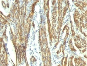 Caldesmon / CAD Antibody Cocktail (HMW)