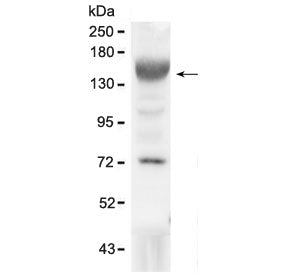 IGF1 Receptor Antibody / IGF1R