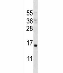 PTH Antibody