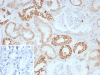 Collagen II Antibody / COL2A1
