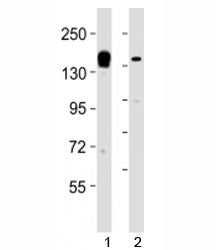 Western blot testing of KDM6A antibody at 1:2000 dilution. Lane 1: human liver lysate; 2: HeLa lysat