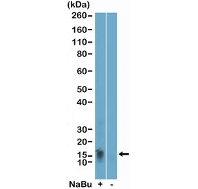 H2BK11ac Antibody / Acetyl-Histone H2B Lysine 11