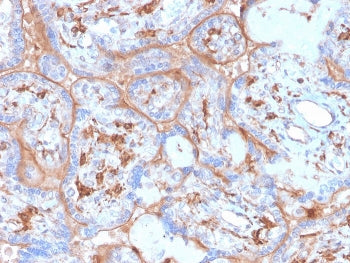 IHC staining of FFPE human placenta with recombinant PDL1 antibody (clone rPDL1/4773). HIER: boil ti