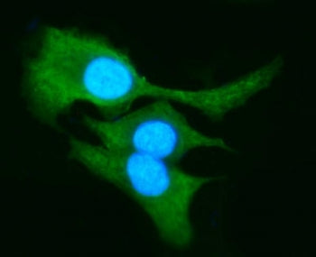 AKR1B10 Antibody