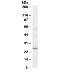 Western blot testing of human heart lysate with KLF16 antibody at 0.3ug/ml. Predicted molecular weig