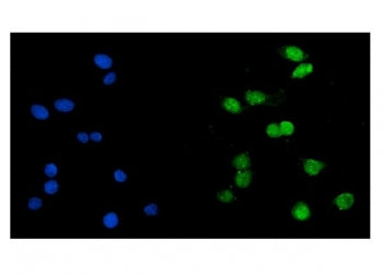 KAT1 Antibody / HAT1