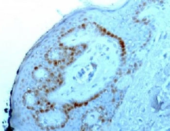 IHC staining of FFPE human skin with Nucleoli Marker antibody. HIER: boil tissue sections in pH6, 10