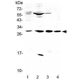 Western blot testing of 1) human placenta, 2) rat pancreas, 3) mouse heart and 4) mouse skeletal mus