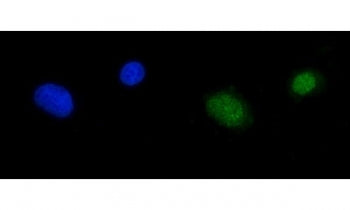 Immunofluorescent staining of FFPE human A549 cells with RPA1 antibody (green) and DAPI nuclear stai