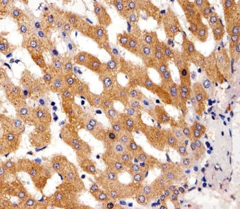 PAH Antibody / Phenylalanine hydroxylase