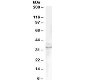 Western blot testing of human prostate lysate with GDF15 antibody at 0.1ug/ml. Predicted molecular w