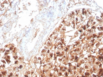 IHC staining of FFPE human pancreas with recombinant Eosinophil Peroxidase antibody (clone rEPO104).