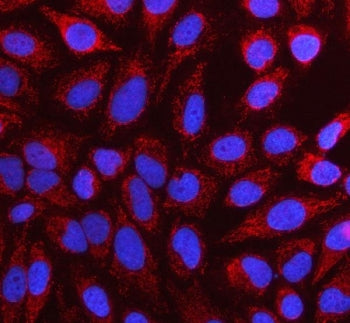 NUBP1 Antibody / Nucleotide-binding protein 1