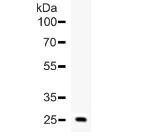 ESM1 Antibody / Endocan