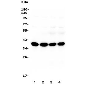 Synaptophysin Antibody