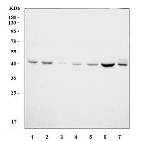 Western blot testing of 1) human HeLa, 2) human Raji, 3) human COLO-320, 4) human MCF7, 5) rat brain