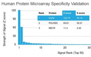Estrogen Receptor beta Antibody