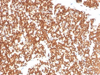 IHC staining of FFPE human thymus with NR5A1 antibody. HIER: boil tissue sections in pH 9 10mM Tris 