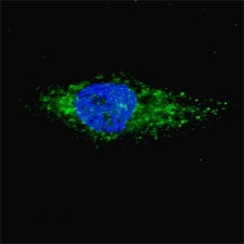 LC3A Antibody (MAP1LC3A)