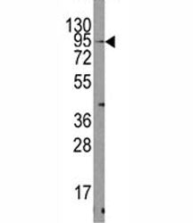 TRPV3 Antibody