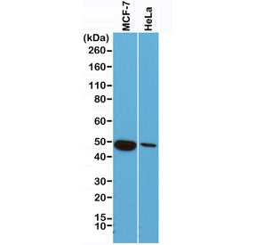 Cytokeratin 18 Antibody