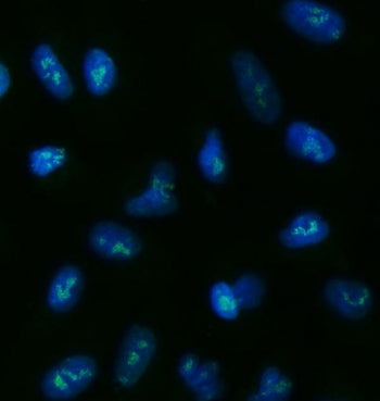 Immunofluorescent staining of FFPE human A549 cells with TOX2 antibody (green) and DAPI nuclear stai