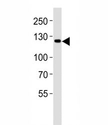 Western blot analysis of lysate from LNCaP cell line using JAK2 antibody diluted at 1:1000. Predicte