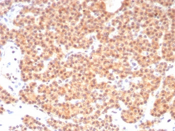 IHC staining of FFPE human parathyroid tissue with c-RET antibody (clone RET/8790). HIER: boil tissu