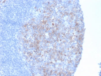 Neprilysin Antibody / CD10
