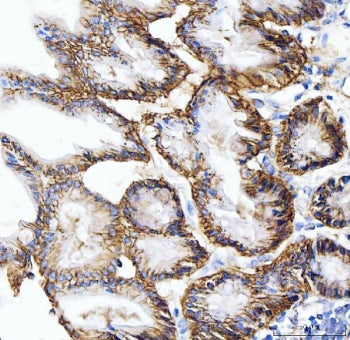 IHC staining of FFPE mouse stomach tissue with Carbonic Anhydrase IX antibody. HIER: boil tissue sec