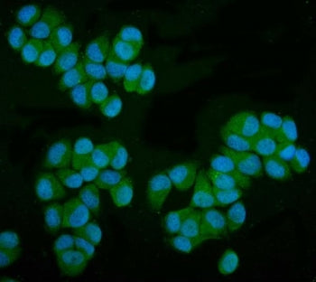 MPI Antibody / Mannose Phosphate Isomerase
