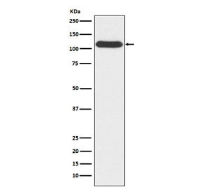 OGT Antibody / O-GlcNAc transferase subunit p110