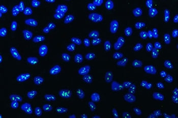 Immunofluorescent staining of FFPE human A549 cells with WD repeat-containing protein 3 antibody (gr