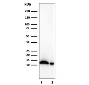 Western blot testing of human 1) LNCaP and 2) PC3 cell lysates using Macrophage Migration Inhibitory