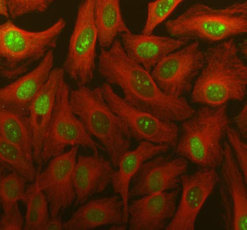 Immunofluorescent staining of FFPE human HeLa cells with TDG antibody (green) and Alpha Tubulin mAb 