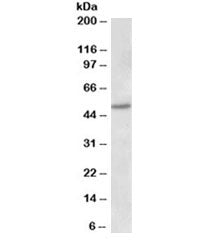 Estrogen receptor beta Antibody