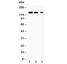 Western blot testing of 1) rat kidney, 2) mouse kidney and 3) human HeLa lysate with JAK1 antibody a