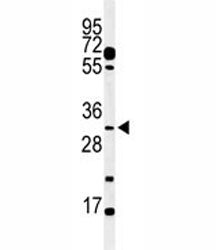 Western blot analysis of PHO3 antibody and mouse testis tissue lysate. Predicted molecular weight ~4