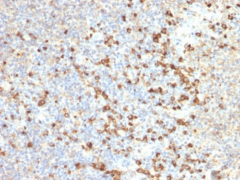IHC staining of FFPE human tonsil with TIM-3 antibody (clone TIM3/2399). HIER: boil tissue sections 