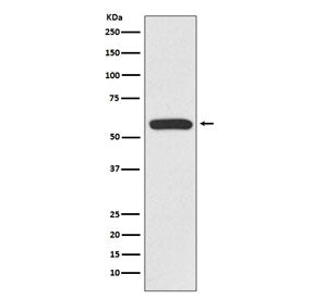 Western blot testing of human Jurkat cell lysate with IRF6 antibody. Predicted molecular weight: ~53