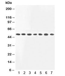 Western blot testing of MEK2 antibody and Lane 1: rat skeletal muscle; 2: rat kidney; and human samp