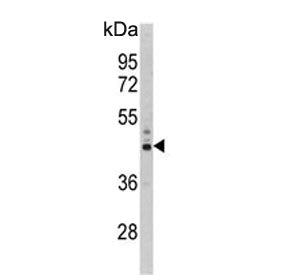 PSMD13 Antibody