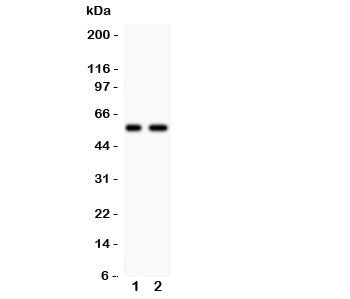 PIASg Antibody (PIAS4)